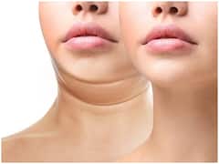 Health Tips: चेहरे का फैट कम करने के लिए करें ये काम, दिखेंगे खूबसूरत
