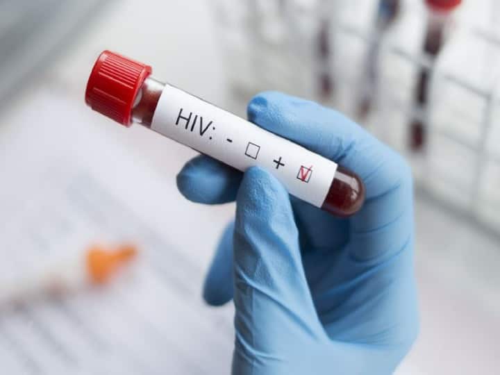 HIV positive woman defeated the virus successful treatment with stem cell transplant पहली बार HIV Positive महिला ने दी वायरस को मात, स्टेमसेल ट्रांसप्लांट से हुआ सफल इलाज