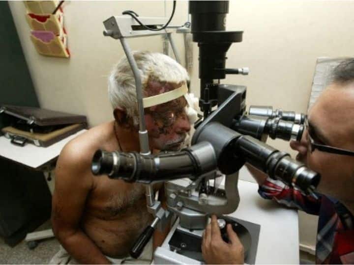 As many as 56 people were killed and over 200 people were injured in the blasts. Indian eye surgeon Dharmesh Modi (R) examines injured Soni Hasmukhlal Vrajlal at The Shri C.H. Nagari Municipal Hospital in Ahmedabad on July 31, 2008, after he was injured in a bomb blast in the western Indian city on July 26, 2008. | Photo: AFP