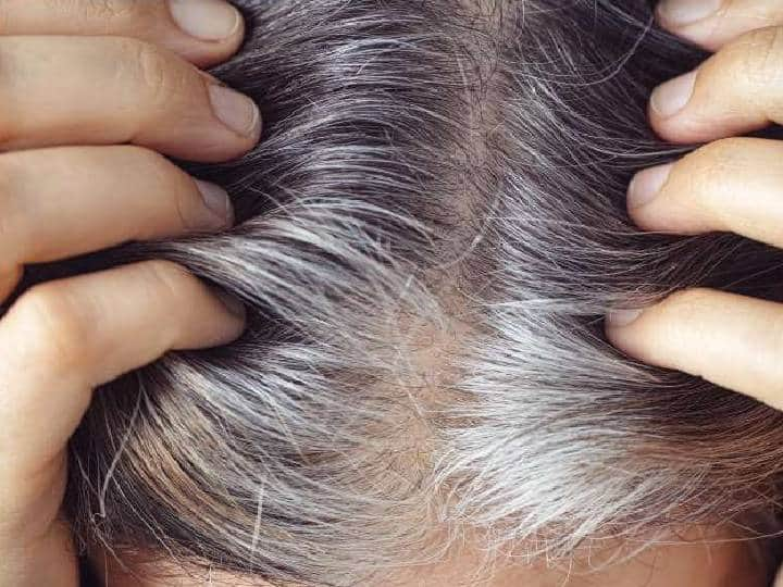 best-home-remedies-for-grey-hair-problem-grey-hair-remedies