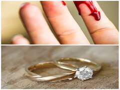 இழுத்த இழுப்புக்கு வராத மோதிரம்.. விரலையே வெட்டிச் சென்ற கொடூர திருடன்!