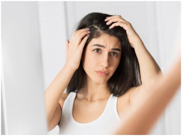 Health Tips, How to get rid of White Hair Problem, Hair Care Tips सफेद बालों की समस्या दूर करने के लिए घर पर ही करें ये जरूरी उपाय, मिलेगा छुटकारा