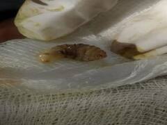 Delhi Woman Botfly: दिल्ली में डॉक्टर ने अमेरिकी महिला के शरीर से निकाले 3 कीड़े, देर होने पर जा सकती थी जान