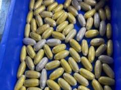 Jaipur Heroin Smuggler: प्राइवेट पार्ट में 16 करोड़ की हेरोइन लेकर जयपुर पहुंची महिला, डॉक्टर ने दो दिन में निकाले 60 कैप्सूल