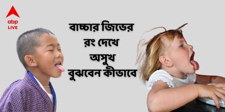 Tongue color What does it say about Child health? Tongue color : বাচ্চার জিভে স্ট্রবেরির মতো লাল নাকি ফ্যাকাসে হয়েছে রং ! স্বাদগ্রন্থিই বলবে শরীরের হাল হকিকত