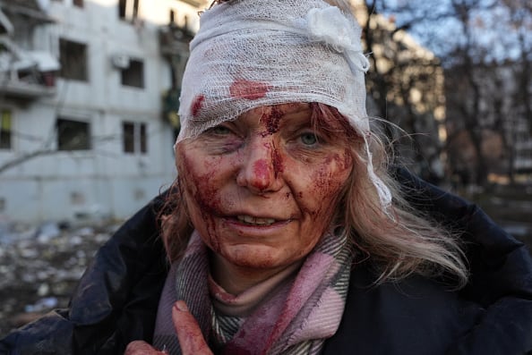 A wounded woman is seen as airstrike damages an apartment complex outside of Kharkiv, Ukraine on February 24, 2022. (File Photo/ Getty Images)