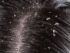 Hair fall Cure Tips: অতিরিক্ত চুল পড়ছে? এই ভুলগুলো শুধরে নিলেই মুশকিল আসান