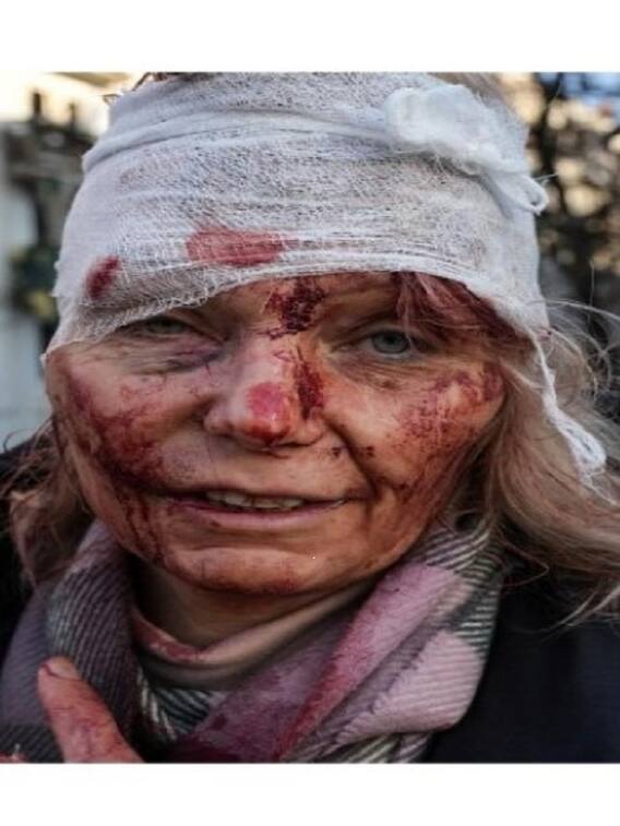 Russia Attacks Ukraine: Images That Speak