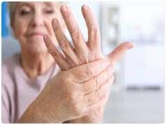 अर्थराइटिस के मरीज इन 5 फलों का करें सेवन, जोड़ों के दर्द में मिलेगा आराम