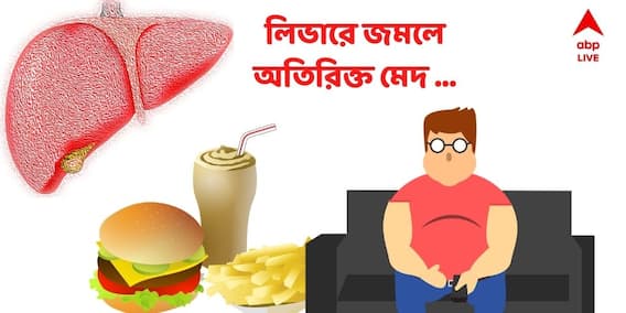 ফ্যাটি লিভারের সমস্যা হয়েছে, বুঝবেন কীভাবে