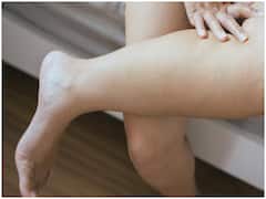 क्या आपके पैरों पर भी दिखती हैं नीली नसें, जानिए कौन सी बीमारी है और क्या है वजह ?