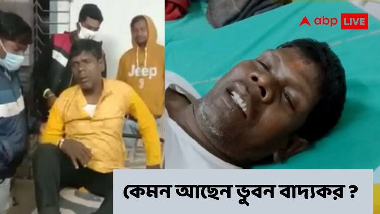 Exclusive Kacha Badam Fame Bhuban Badyakar Health Update in details after he met an accident Bhuban Badyakar Health Update : কতটা গুরুতর চোট? কেমন আছেন ভুবন বাদ্যকর?