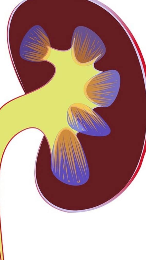 কিডনিতে পাথর জমার লক্ষণ