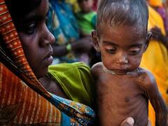 Maharashtra: कोरोना महामारी के बीच महाराष्ट्र सरकार ने हासिल किया ये मुकाम, अति गंभीर कुपोषित बच्चों की संख्या में आई कमी