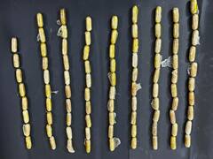 Jaipur News: विदेशी महिला प्राइवेट पार्ट में छुपाकर लाई थी 88 ड्रग्स के कैप्सूल, डॉक्टरों को निकालने में लग गए 12 दिन