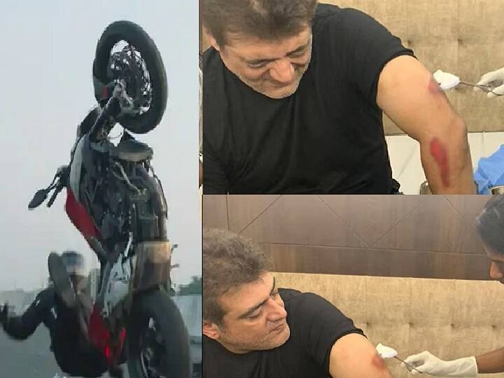 Valimai Bike Accident: Ajith Kumar Doctor Interview About his Operations Ajith Kumar Doctor Interview:  கையில் ரத்தம்.. வலியால் துடித்த அஜித்.. வலிமை விபத்துக்கு பின் நடந்தது இதுதான்!!