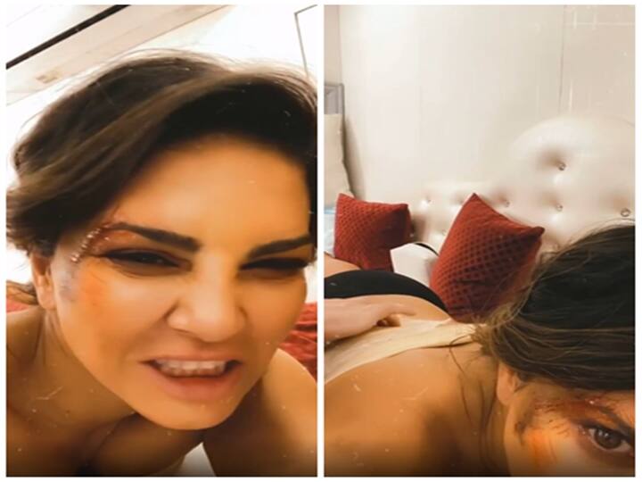 Watch Video: சன்னி லியோனுக்கு என்னாச்சு..? முகம், முதுகில் காயம்.. - வைரலாகும் வீடியோ