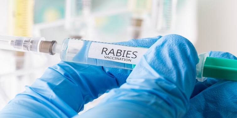 Beleghata ID Hospital starts mobile message reminder for rabies vaccine for patient Rabies Vaccine: জলাতঙ্ক টিকার জন্য বিশেষ ব্যবস্থা আনছে বেলেঘাটা আইডি, রোগীদের স্বার্থেই নয়া উদ্যোগ