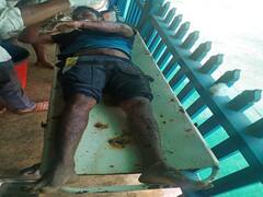 Bijapur News: नक्सलियों ने बैनर-पोस्टर के पास लगाया प्रेशर बम, चपेट में आया एक पुलिसकर्मी बुरी तरह घायल