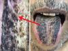 Hair on Tongue: ఓ మై గాడ్, ఇతడి నాలుకపై జుట్టు పెరుగుతోంది, కారణం తెలిస్తే ఇక నిద్రపట్టదు!
