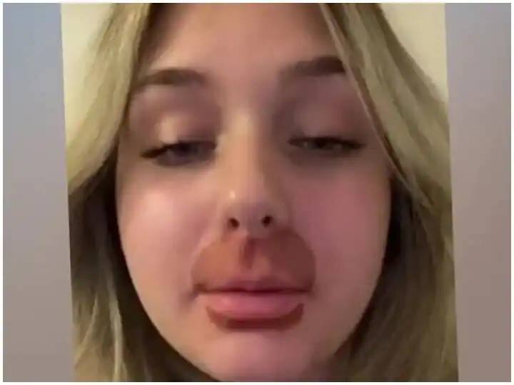 Tiktok star lip surgery gone wrong photo goes viral on internet Viral : अरे देवा! सुंदर ओठांच्या नादात महिलेने हे काय केले? फोटो पाहून तुम्हीही चुकचुकाल...