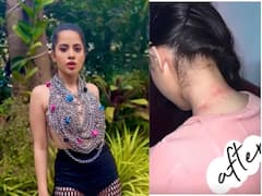 Urfi Javed : साखळी अन् कुलुपांचा टॉप घालणं उर्फीला पडलं महागात; मानेचा फोटो पाहून नेटकरी थक्क