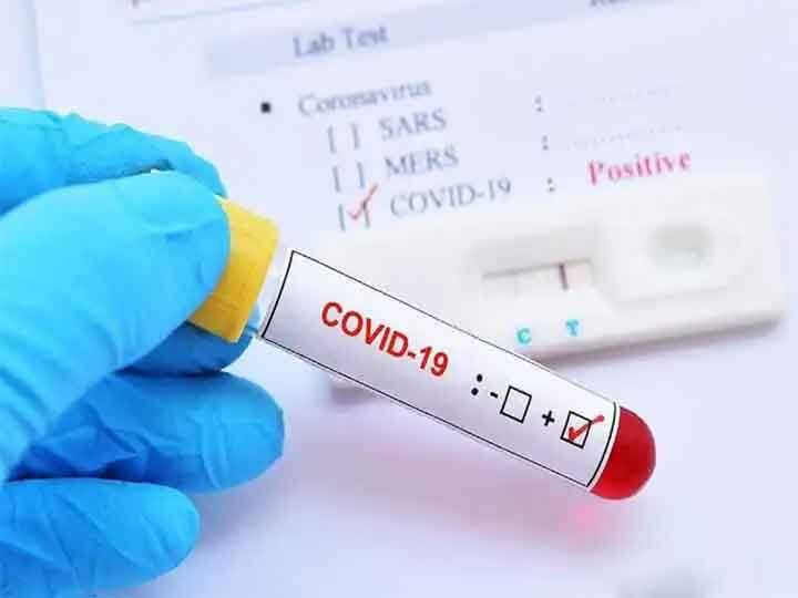 Covid-19 Cases are increasing in China and USA Centre for disease control and prevention data show the covid trends Know in detail   अमेरिका में भी बढ़ रहे हैं कोविड-19 के मामले? क्या हैं संकेत