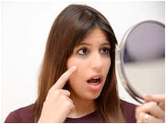 आपकी स्किन है एक्ने प्रोन? मेकअप अप्लाई करते समय इन बातों का रखें ध्यान