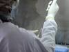 US Scientists Develop Nipah Virus Vax That Can Save Lives In Just 3 Days