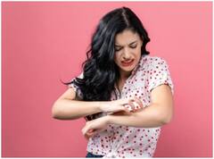 आप भी हैं खुजली के दानों से परेशान? इन घरेलू तरीकों से पाएं आराम