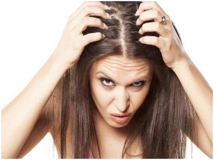 Health Tips, Follow These Steps to take care of oily scalp, Hair Care Tips ऑयली स्कैल्प की देखभाल करने के लिए अपनाएं ये उपाय, बालों में खुजली से मिलेगा छुटकारा