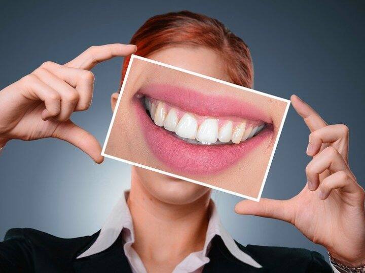 Tooth decay is also inherited, a shocking result in the study New Study: పిప్పి పళ్లు కూడా వారసత్వంగా వస్తాయిట, అధ్యయనంలో షాకింగ్ ఫలితం