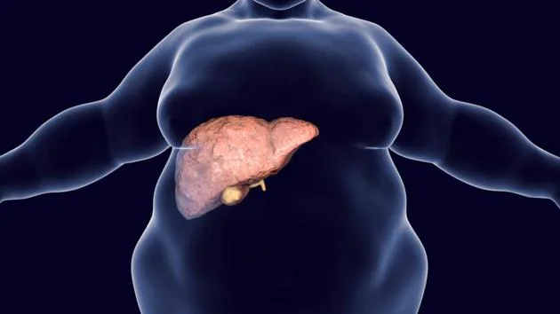 Fatty Liver : கல்லீரல் கொழுப்பு உங்களுக்கு இருக்கும்னு சந்தேகமா? இதெல்லாம் அறிகுறிகள்..