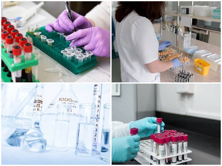 राजस्थान स्टाफ सेलेक्शन बोर्ड ने लैब असिस्टेंट के पदों पर भर्ती निकाली है. इस रिक्रूटमेंट ड्राइव के माध्यम से कुल 1012 पद भरे जाएंगे. राजस्थान में सरकारी नौकरी पाने का ये बढ़िया मौका है. इन पदों पर भर्ती की प्रक्रिया अभी शुरू नहीं हुई है. कुछ ही दिनों में इन पदों के लिए आवेदन किया जा सकेगा. आरएसएमएसएसबी के इन पदों के बारे में लेटेस्ट जानकारी पाने के लिए आधिकारिक वेबसाइट पर नजर रखें.