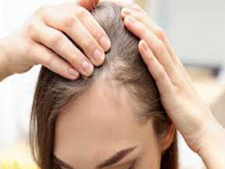 try these home remedies to get rid of hairfall 3 மாதத்தில் முடி வளர்ச்சியில் வித்தியாசம் தெரியனுமா ? - இந்த டிப்சை மறக்காம ஃபாலோ பண்ணுங்க...!