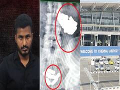 Crime : அயன் படத்தின் பாணியில் வயிற்றில் கடத்தப்பட்ட தங்கம்.. நடுவில் குழப்பம்.. அடித்து அப்போலோவில் அட்மிட் செய்த கும்பல்..சென்னையில் பகீர்