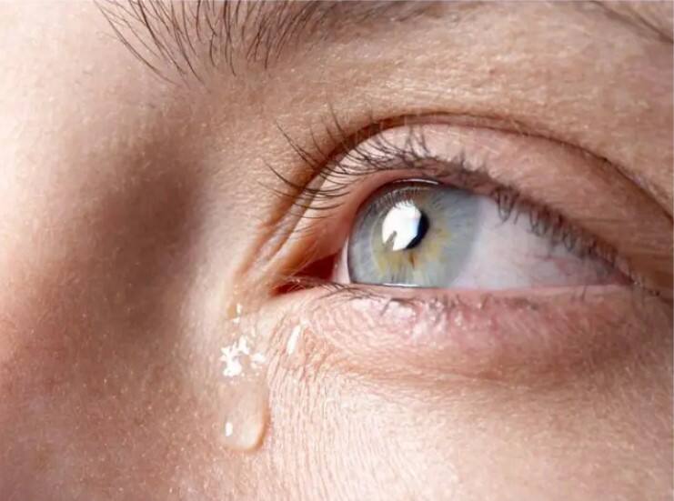 Water In The Eye Watery Eyes Problem Know Reason Health Tips