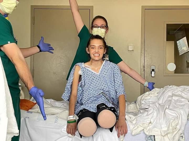 Model Loses Her Legs Due To Covid-19 Complications ఆమె కలలను కాజేసిన కరోనా పిశాచి, కాళ్లు కోల్పోయి నరకం అనుభవిస్తున్న మోడల్, కారణం ఏమిటీ?