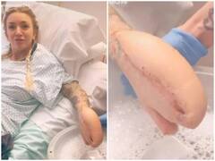 महिला को हुई ऐसी बीमारी कि शार्क मछली की तरह दिखने लगा हाथ, पढ़ें पूरी कहानी