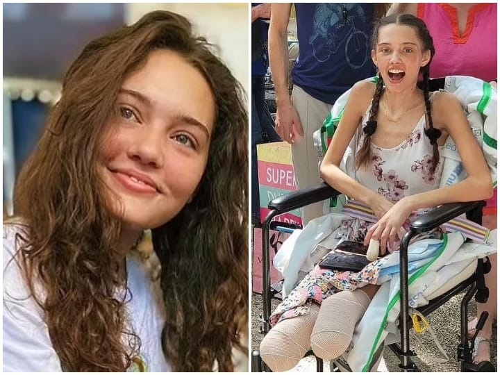 21 year old model lost both legs, yet she is happy with her life 21 साल की मॉडल को गंवाने पड़े दोनों पैर, फिर भी अपने जीवन से है खुश, ऐसे मनाया अपना जन्मदिन