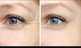 Skin Care Tips: ਘੱਟ ਉਮਰ 'ਚ ਚਿਹਰੇ 'ਤੇ ਦਿਖ ਰਹੀਆਂ ਝੁਰੜੀਆਂ? ਇਹ ਹੋ ਸਕਦੇ ਹਨ ਕਾਰਨ