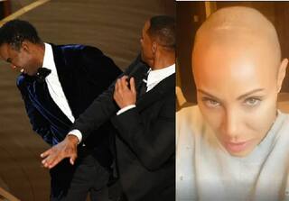 Will Smith Wife : ஆஸ்கர் விழாவில் உருவகேலிக்கு ஆளான வில் ஸ்மித் மனைவி.. அலோபீஷியா குறைபாடு என்றால் என்ன?