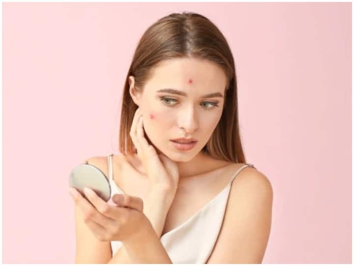 Health Tips, Follow these Makeup tips to hide Facial Acne, Skin Care Tips चेहरे के मुहांसे छुपाने के लिए फॉलो करें ये मेकअप टिप्स