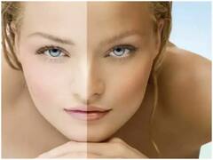 Summer skinCare tips :ચહેરા પર સનબર્ન થઇ ગયું છે તો ભૂલથી પણ ન કરો આ કામ, સ્કિન વધુ થશે ડેમેજ