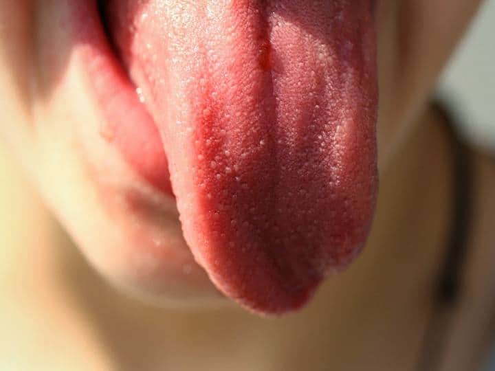 Your health can be assessed based on the color of your tongue Tongue: మీ నాలుక రంగుని బట్టి మీ ఆరోగ్యం అంచనా వేయచ్చు
