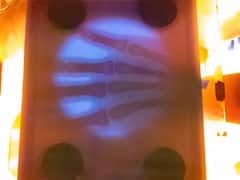 Hospital Bills : 2 రోజుల ఆస్పత్రి బిల్లు రూ. 52 లక్షలు ! కడుపు మండిపోదా మరి , కానీ అందరిలాగా సైలెంట్‌గా లేడు