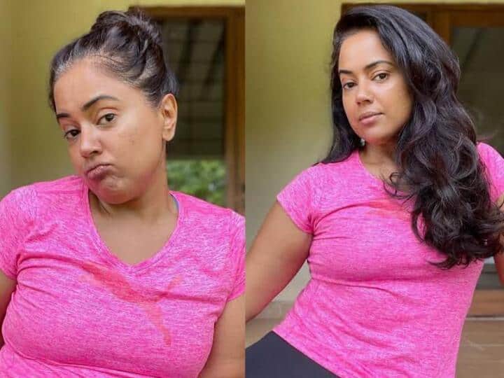 I also had alopecia hair loss Sameera Reddy posted after the Oscars hype எனக்கும் அதே நோய் இருந்தது.. ஆஸ்கார் விழாவில் விழுந்த அறை.. சமீரா ரெட்டி சொன்ன ஷாக் தகவல்..