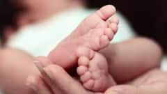 Caesarean Delivery: সরকারি হাসপাতালে মাত্রাতিরিক্ত সিজারিয়ান বেবি, অডিট করবে রাজ্য। Bangla News