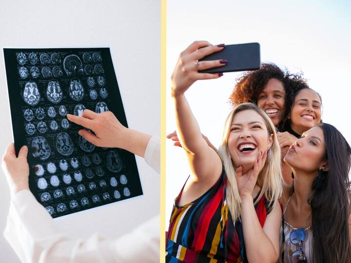 Mobile phones do not increase the risk of brain tumours, study reveals Brain Tumour With Mobile: మొబైల్ అతిగా వాడితే మెదడులో కణితి? మీరు ఈ గుడ్ న్యూస్ వినాల్సిందే!