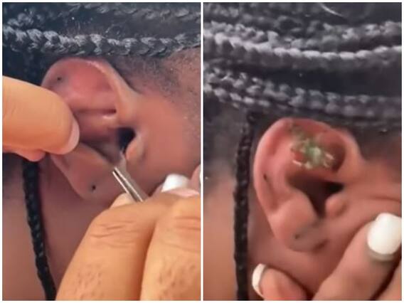 समुद्र में तैरने के दौरान महिला के कान में घुसा केकड़ा, दिल-दहला देगा वीडियो समुद्र में तैरने के दौरान महिला के कान में घुसा केकड़ा, दिल-दहला देगा वीडियो